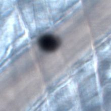 New publication in Journal of Investigative Dermatology in collaboration with Hospital Universitario Dr. Peset