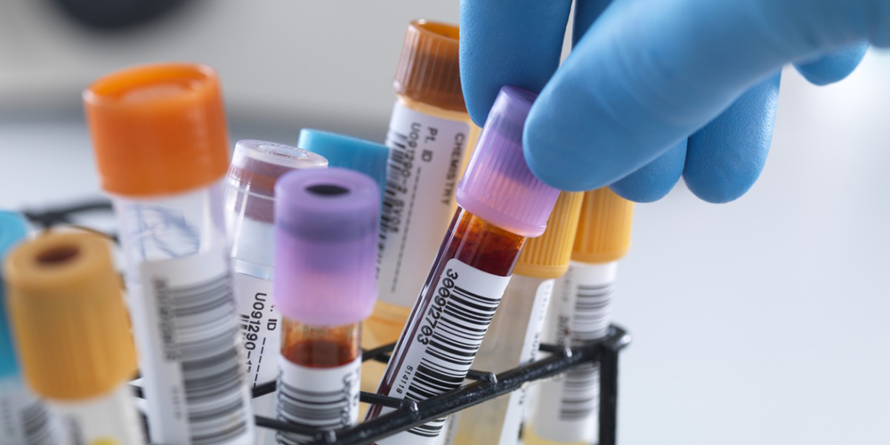 Postgraduate position/ Doctoral programme