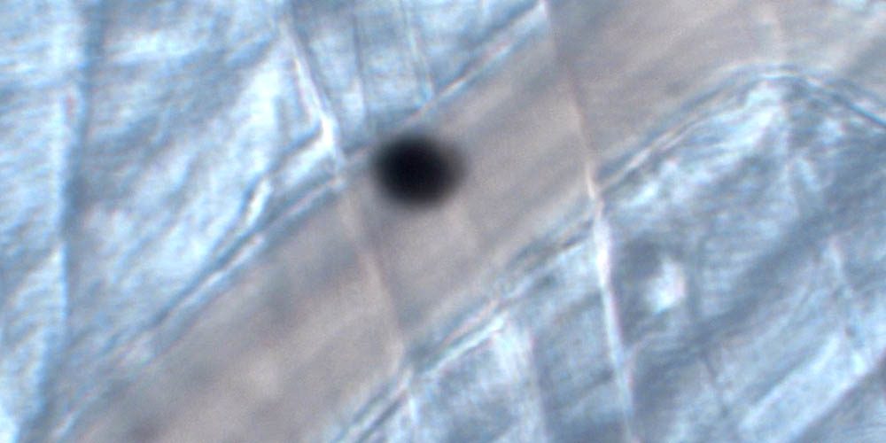 Nueva publicación en Journal of Investigative Dermatology en colaboración con Hospital  Universitario Dr. Peset