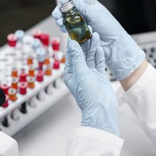 Se busca candidato o candidata para solicitar una beca para realizar la tesis doctoral en el área de Farmacología